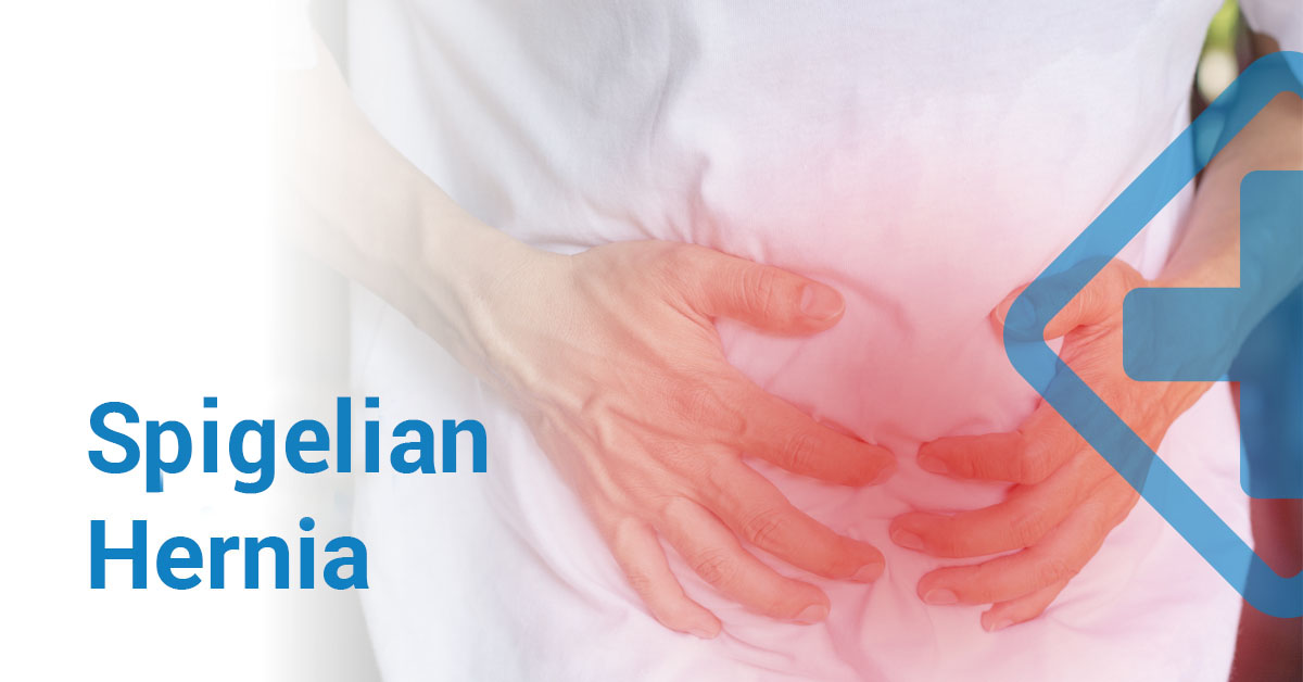 Spigelian Hernia